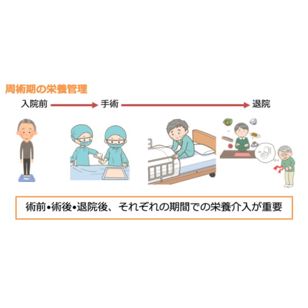 周術期 1/4 | 消化器外科の術前・術後の腸管機能評価(※pptxダウンロード可) - 画像 (4)