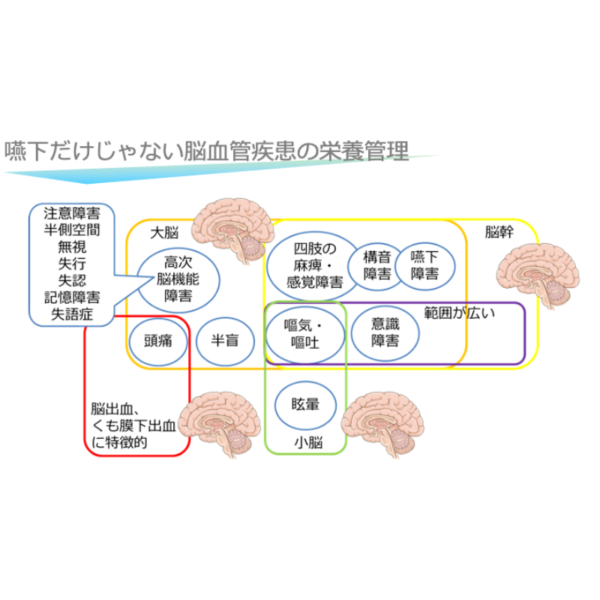 脳血管疾患1/4 | 栄養管理に必要な脳血管疾患の基本(※pptxダウンロード可) - 画像 (3)