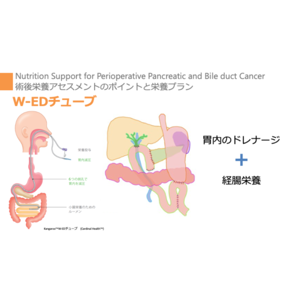 周術期 4/4 | 膵・胆管周術期栄養管理のポイント(※pptxダウンロード可) - 画像 (4)