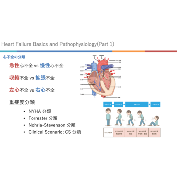 心不全1/4 | 心不全の基礎と病態生理(前編)(※pptxダウンロード可) - 画像 (2)