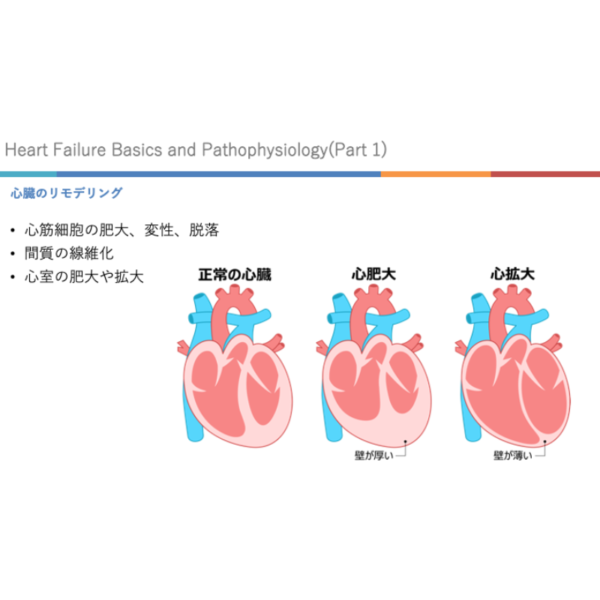心不全1/4 | 心不全の基礎と病態生理(前編)(※pptxダウンロード可) - 画像 (4)