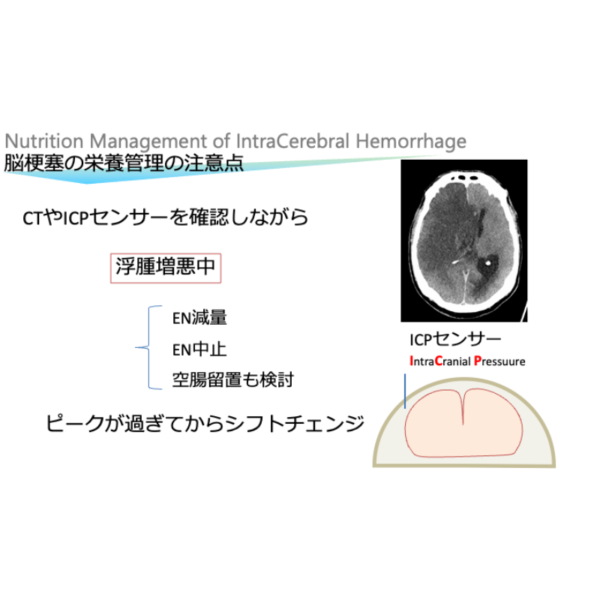 脳血管疾患3/4 | 脳梗塞の栄養管理(※pptxダウンロード可) - 画像 (4)